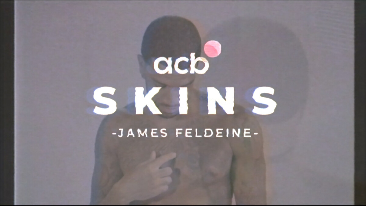 Skins acb: James Feldeine