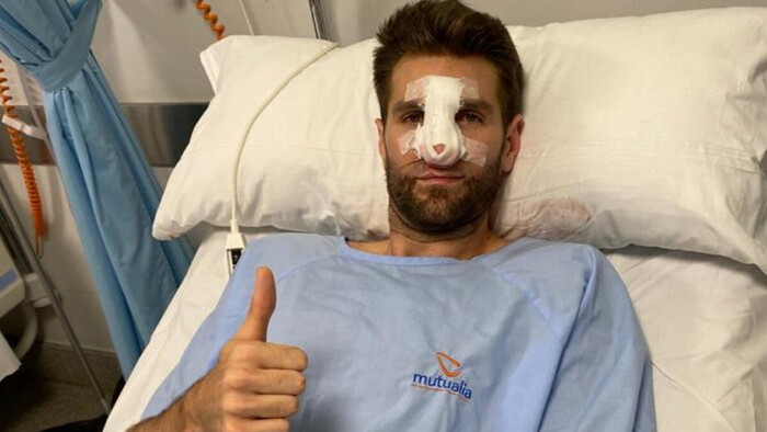 Jeff Withey intervenido con éxito tras una fractura en la nariz